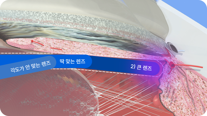 각도가 안 맞는 렌즈, 딱 맞는 렌즈, 2) 큰 렌즈