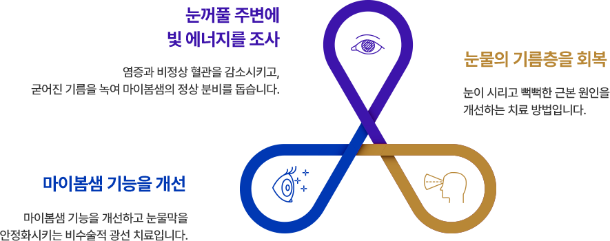 1.눈꺼풀 주변에 빛 에너지를 조사 : 염증과 비정상 혈관을 감소시키고, 굳어진 기름을 녹여 마이봄샘의 정상 분비를 돕습니다., 2. 눈물의 기름층을 회복: 눈이 시리고 뻑뻑한 근본 원인을 개선하는 치료 방법입니다., 3. 마이봄샘 기능을 개선 : 마이봄샘 기능을 개선하고 눈물막을 안정화시키는 비수술적 광선 치료입니다.