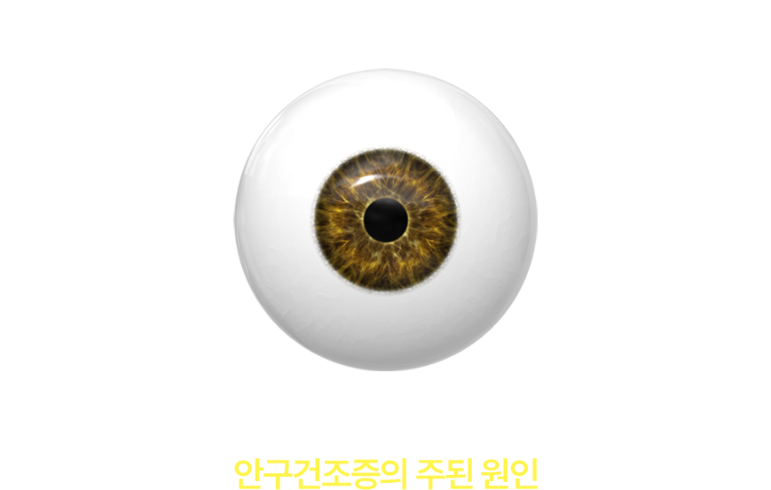  단순 눈물 부족이 아닌 마이봄샘 기능장애, 기름층이 무너지면 눈물이 빨리 증발, 염증과 비정상  혈관이 악순환 유발, 안구건조증의 주된 원인