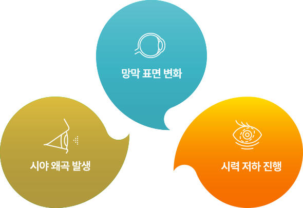 망막 표면 변화 , 시야 왜곡 발생 , 시력 저하 진행